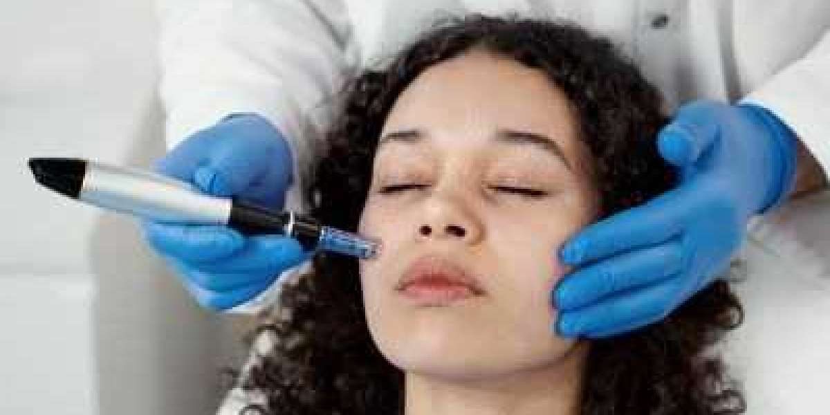 Microneedling in Islamabad – Advanced Skin Regeneration for Deep Repair and Lasting Glow